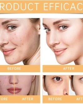 • The Ordinary Glycolic Acid